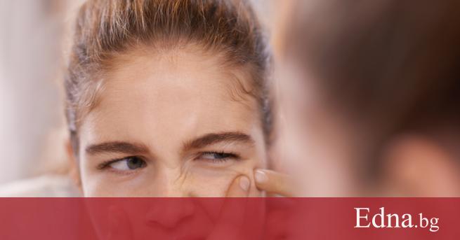 Когато си на 13 смяташ че акнето е най голямото