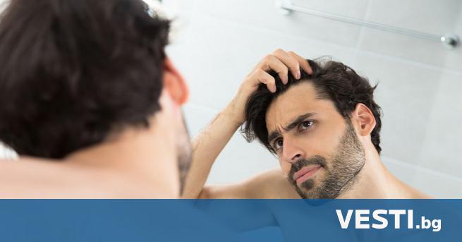 Все по-голям брой мъже страдат от косопад и ново изследване